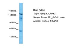 JCAD Rabbit anti-Human, Polyclonal, Novus Biologicals 0.1 mL | Buy Online | Novus Biologicals | Fisher Scientific